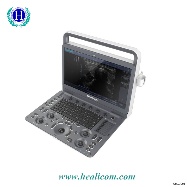 Bệnh viện chuyên nghiệp SonoScape E2 sử dụng hệ thống chẩn đoán máy siêu âm Doppler màu kỹ thuật số đầy đủ